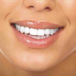 Endodoncia Anterior No Vital