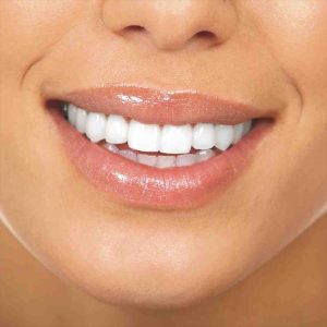 Endodoncia Anterior No Vital