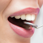 Endodoncia Anterior Vital
