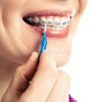 Retratamiento Premolar