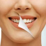 Examen Periodontal