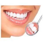 Composite Anterior con Ángulo